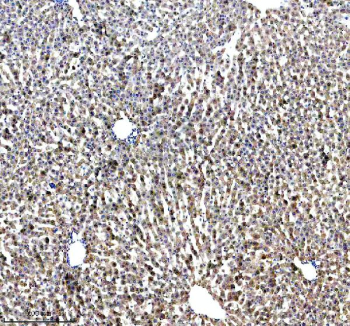 Immunohistochemical staining of LRG1 using anti-LRG1 antibody. LRG1 was detected in a paraffin-embedded section of rat liver tissue. Heat mediated antigen retrieval was performed in EDTA buffer (pH 8.0, epitope retrieval solution). The tissue section was blocked with 10% goat serum. The tissue section was then incubated with 1:100 rabbit anti-LRG1 antibody overnight at 4oC. Peroxidase Conjugated Goat Anti-rabbit IgG was used as secondary antibody and incubated for 30 minutes at 37oC. The tissue section was developed using an HRP secondary and DAB substrate.