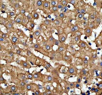 Immunohistochemical staining of LRG1 using anti-LRG1 antibody. LRG1 was detected in a paraffin-embedded section of human liver tissue. Heat mediated antigen retrieval was performed in EDTA buffer (pH 8.0, epitope retrieval solution). The tissue section was blocked with 10% goat serum. The tissue section was then incubated with 2 ug/ml rabbit anti-LRG1 antibody overnight at 4oC. Peroxidase Conjugated Goat Anti-rabbit IgG was used as secondary antibody and incubated for 30 minutes at 37oC. The tissue section was developed using an HRP secondary and DAB substrate.