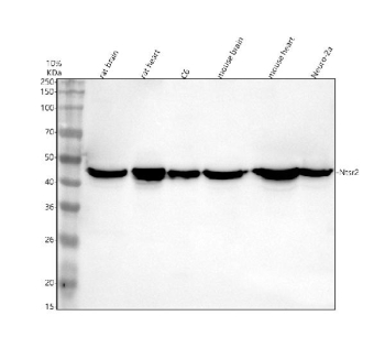 Western blot analysis of NTSR2 using anti-NTSR2 antibody. Electrophoresis was performed on a 10% SDS-PAGE gel at 80V (Stacking gel) / 120V (Resolving gel) for 2 hours. Lane 1: rat brain tissue lysates, Lane 2: rat heart tissue lysates, Lane 3: rat C6 whole cell lysates, Lane 4: mouse brain tissue lysates, Lane 5: mouse heart tissue lysates, Lane 6: mouse Neuro-2a whole cell lysates. After electrophoresis, proteins were transferred to a nitrocellulose membrane at 150 mA for 50-90 minutes. Blocked the membrane with 5% non-fat milk/TBS for 1.5 hour at RT. The membrane was incubated with rabbit anti-NTSR2 antibody at 0.5 ug/ml overnight at 4oC, then washed with TBS-0.1%Tween 3 times with 5 minutes each and probed with a goat anti-rabbit IgG-HRP secondary antibody at a dilution of 1:5000 for 1.5 hour at RT. The signal was developed using an ECL Plus Western Blotting Substrate. A specific band was detected for NTSR2 at approximately 45 kDa. The expected molecular weight of NTSR2 is ~45 kDa.