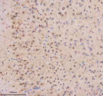 Immunohistochemical staining of THRAP3 using anti-THRAP3 antibody. THRAP3 was detected in a paraffin-embedded section of mouse brain tissue. Heat mediated antigen retrieval was performed in EDTA buffer (pH 8.0, epitope retrieval solution). The tissue section was blocked with 10% goat serum. The tissue section was then incubated with 2 ug/ml rabbit anti-THRAP3 antibody overnight at 4oC. Peroxidase Conjugated Goat Anti-rabbit IgG was used as secondary antibody and incubated for 30 minutes at 37oC. The tissue section was developed using an HRP secondary and DAB substrate.