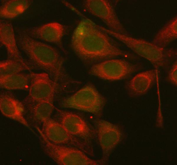 AXIN1 Antibody HeLa Cell IF. Immunofluorescent staining of HeLa cells using AXIN1 Antibody / Wnt Signaling Scaffold Protein Antibody demonstrates predominantly cytoplasmic green fluorescence throughout the cellular compartment, consistent with the established localization of Axis Inhibition Protein 1 (AXIN1) as a scaffold protein within the Wnt/beta-catenin signaling pathway. Co-staining with Beta Tubulin (red) highlights the cytoskeletal network and provides cellular structural reference. The observed AXIN1 staining pattern is consistent with its role in assembling the beta-catenin destruction complex and coordinating intracellular signal transduction events that regulate cellular differentiation, proliferation, and developmental signaling. Enzyme antigen retrieval was performed for 15 minutes prior to staining. Cells were incubated with primary antibodies overnight at 4oC followed by fluorescent secondary antibody detection and visualization by fluorescence microscopy.