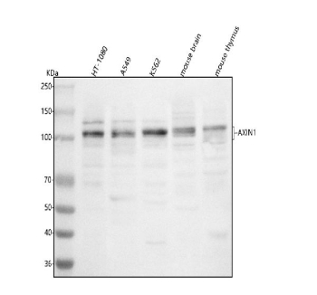 AXIN1 Antibody Multi-Species WB. Western blot analysis of human HT-1080, human A549, human K562, mouse brain, and mouse thymus lysates using AXIN1 Antibody / Wnt Signaling Scaffold Protein Antibody demonstrates a predominant immunoreactive band migrating slightly above 100 kDa across all samples tested. The observed molecular weight is consistent with the expected size of Axis Inhibition Protein 1 (AXIN1), a scaffold protein that serves as a central regulator of the Wnt/beta-catenin signaling pathway. AXIN1 frequently migrates at a higher apparent molecular weight than predicted due to extensive phosphorylation, a known regulatory mechanism that influences protein stability and signaling activity. Additional weaker bands observed above and below the major species may represent post-translationally modified forms, ubiquitinated species, or limited proteolytic products. Detection of AXIN1 in both human and mouse samples is consistent with the highly conserved role of this protein in developmental signaling, beta-catenin regulation, cellular differentiation, and tissue homeostasis.