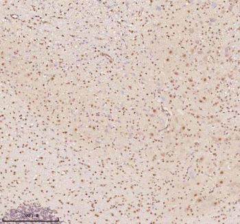 Immunohistochemical staining of AATF using anti-AATF antibody. AATF was detected in a paraffin-embedded section of mouse cerebellum tissue. Heat mediated antigen retrieval was performed in EDTA buffer (pH 8.0, epitope retrieval solution). The tissue section was blocked with 10% goat serum. The tissue section was then incubated with 2 ug/ml rabbit anti-AATF antibody overnight at 4oC. Peroxidase Conjugated Goat Anti-rabbit IgG was used as secondary antibody and incubated for 30 minutes at 37oC. The tissue section was developed using an HRP secondary and DAB substrate.