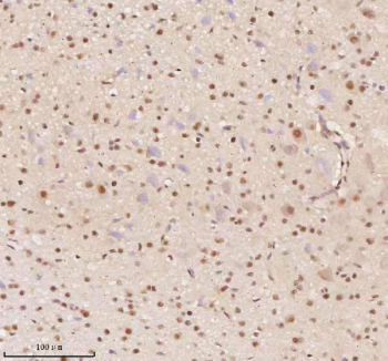 Immunohistochemical staining of AATF using anti-AATF antibody. AATF was detected in a paraffin-embedded section of mouse cerebellum tissue. Heat mediated antigen retrieval was performed in EDTA buffer (pH 8.0, epitope retrieval solution). The tissue section was blocked with 10% goat serum. The tissue section was then incubated with 2 ug/ml rabbit anti-AATF antibody overnight at 4oC. Peroxidase Conjugated Goat Anti-rabbit IgG was used as secondary antibody and incubated for 30 minutes at 37oC. The tissue section was developed using an HRP secondary and DAB substrate.