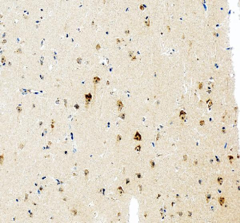 Immunohistochemical staining of AATF using anti-AATF antibody. AATF was detected in a paraffin-embedded section of human brain tissue. Heat mediated antigen retrieval was performed in EDTA buffer (pH 8.0, epitope retrieval solution). The tissue section was blocked with 10% goat serum. The tissue section was then incubated with 2 ug/ml rabbit anti-AATF antibody overnight at 4oC. Peroxidase Conjugated Goat Anti-rabbit IgG was used as secondary antibody and incubated for 30 minutes at 37oC. The tissue section was developed using an HRP secondary and DAB substrate.