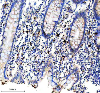 CD163 Like 1 Antibody Appendix IHC. Immunohistochemistry analysis of FFPE human appendix tissue using CD163 Like 1 Antibody demonstrates distinct cytoplasmic and membranous HRP-DAB brown staining in scattered macrophage-like immune cells distributed throughout the appendiceal lamina propria. The staining pattern is consistent with expression of CD163 Like 1 / CD163L1 (CD163b), a scavenger receptor family protein associated with monocyte-macrophage lineage populations and innate immune regulation. Positive cells are observed within the immune-rich stromal compartment surrounding glandular structures, supporting the established association of CD163L1 with tissue-resident myeloid cells involved in immune surveillance and inflammatory responses. Heat-mediated antigen retrieval was performed in EDTA buffer (pH 8.0) prior to staining.