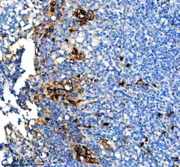 CD163 Like 1 Antibody Tonsil IHC. Immunohistochemistry analysis of FFPE human tonsil tissue using CD163 Like 1 Antibody demonstrates distinct membranous and cytoplasmic HRP-DAB brown staining in scattered macrophage-like cells within the lymphoid microenvironment. The staining pattern is consistent with expression of CD163 Like 1 / CD163L1 (CD163b), a scavenger receptor family protein associated with monocyte-macrophage lineage populations and innate immune regulation. Positive cells are concentrated within stromal and immune cell-rich regions of the tonsil, supporting the established association of CD163L1 with tissue-resident myeloid cells involved in antigen handling, immune surveillance, and maintenance of lymphoid tissue homeostasis. Heat-mediated antigen retrieval was performed in EDTA buffer (pH 8.0) prior to staining.