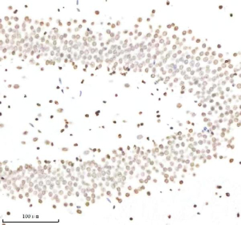 Immunohistochemical staining of Histone H3 (acetyl K9) using anti-Histone H3 (acetyl K9) antibody. Histone H3 (acetyl K9) was detected in a paraffin-embedded section of rat brain tissue. Heat mediated antigen retrieval was performed in EDTA buffer (pH 8.0, epitope retrieval solution). The tissue section was blocked with 10% goat serum. The tissue section was then incubated with 1:50 rabbit anti-Histone H3 (acetyl K9) antibody overnight at 4oC. Peroxidase Conjugated Goat Anti-rabbit IgG was used as secondary antibody and incubated for 30 minutes at 37oC. The tissue section was developed using an HRP secondary and DAB substrate.