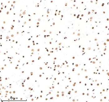 H3K9ac Antibody / HIST1H3A Promoter Activation Marker Antibody (clone 32H23). Immunohistochemistry analysis of HIST1H3A / Histone H3 Lys9 acetylation in rat brain tissue using H3K9ac Antibody / HIST1H3A Promoter Activation Marker Antibody. Strong HRP-DAB brown nuclear staining is observed in neuronal and glial cell populations, consistent with euchromatic localization and promoter-associated transcriptional activation, while background staining remains low in surrounding tissue structures.