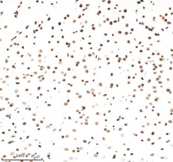 Immunohistochemical staining of Histone H3 (acetyl K9) using anti-Histone H3 (acetyl K9) antibody. Histone H3 (acetyl K9) was detected in a paraffin-embedded section of mouse brain tissue. Heat mediated antigen retrieval was performed in EDTA buffer (pH 8.0, epitope retrieval solution). The tissue section was blocked with 10% goat serum. The tissue section was then incubated with 1:50 rabbit anti-Histone H3 (acetyl K9) antibody overnight at 4oC. Peroxidase Conjugated Goat Anti-rabbit IgG was used as secondary antibody and incubated for 30 minutes at 37oC. The tissue section was developed using an HRP secondary and DAB substrate.