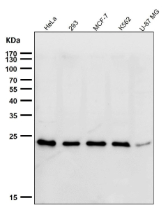 Western blot testing of human samples using the UBE2T antibody at 1:1000 dilution for 1 hour at room temperature. Predicted molecular weight ~22 kDa.