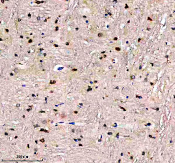 Immunohistochemical staining of EVC2 using anti-EVC2 antibody. EVC2 was detected in a paraffin-embedded section of rat midbrain tissue. Heat mediated antigen retrieval was performed in EDTA buffer (pH 8.0, epitope retrieval solution). The tissue section was blocked with 10% goat serum. The tissue section was then incubated with 2 ug/ml rabbit anti-EVC2 antibody overnight at 4oC. Peroxidase Conjugated Goat Anti-rabbit IgG was used as secondary antibody and incubated for 30 minutes at 37oC. The tissue section was developed using an HRP secondary and DAB substrate.