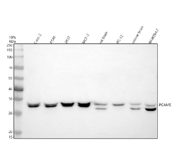 Western blot analysis of PGAM5 using anti-PGAM5 antibody. Electrophoresis was performed on a 10% SDS-PAGE gel at 80V (Stacking gel) / 120V (Resolving gel) for 2 hours. Lane 1: human Caco-2 whole cell lysates, Lane 2: human whole cell lysates, Lane 3: human 293T whole cell lysates, Lane 4: human MCF-7 whole cell lysates, Lane 5: rat brain tissue lysates, Lane 6: rat PC-12 whole cell lysates, Lane 7: mouse brain tissue lysates, Lane 8: mouse RAW264.7 whole cell lysates. After electrophoresis, proteins were transferred to a nitrocellulose membrane at 150 mA for 50-90 minutes. Blocked the membrane with 5% non-fat milk/TBS for 1.5 hour at RT. The membrane was incubated with rabbit anti-PGAM5 antibody at 0.5 ug/ml overnight at 4oC, then washed with TBS-0.1%Tween 3 times with 5 minutes each and probed with a goat anti-rabbit IgG-HRP secondary antibody at a dilution of 1:5000 for 1.5 hour at RT. The signal was developed using an ECL Plus Western Blotting Substrate. Western blot detection of PGAM5 shows a tight doublet at ~32 kDa in human cell lines, consistent with isoform and processing heterogeneity, and an additional ~28 kDa band in mouse and rat brain and RAW264.7 lysate that matches the known PARL-processed form of PGAM5.