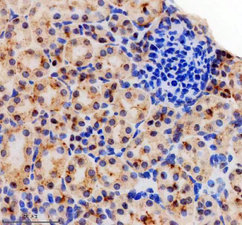 Immunohistochemical staining of SRA1 using anti-SRA1 antibody. SRA1 was detected in a paraffin-embedded section of mouse kidney tissue. Heat mediated antigen retrieval was performed in EDTA buffer (pH 8.0, epitope retrieval solution). The tissue section was blocked with 10% goat serum. The tissue section was then incubated with 1: 200 rabbit anti-SRA1 antibody overnight at 4oC. Peroxidase Conjugated Goat Anti-rabbit IgG was used as secondary antibody and incubated for 30 minutes at 37oC. The tissue section was developed using an HRP secondary and DAB substrate.