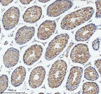 Immunohistochemical staining of DIS3 using anti-DIS3 antibody. DIS3 was detected in a paraffin-embedded section of mouse testis tissue. Heat mediated antigen retrieval was performed in EDTA buffer (pH 8.0, epitope retrieval solution). The tissue section was blocked with 10% goat serum. The tissue section was then incubated with 2 ug/ml rabbit anti-DIS3 antibody overnight at 4oC. Peroxidase Conjugated Goat Anti-rabbit IgG was used as secondary antibody and incubated for 30 minutes at 37oC. The tissue section was developed using an HRP secondary and DAB substrate.