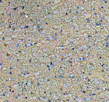 Immunohistochemical staining of SBK1 using anti-SBK1 antibody. SBK1 was detected in a paraffin-embedded section of rat cerebellum tissue. Heat mediated antigen retrieval was performed in EDTA buffer (pH 8.0, epitope retrieval solution). The tissue section was blocked with 10% goat serum. The tissue section was then incubated with 2 ug/ml rabbit anti-SBK1 antibody overnight at 4oC. Peroxidase Conjugated Goat Anti-rabbit IgG was used as secondary antibody and incubated for 30 minutes at 37oC. The tissue section was developed using an HRP secondary and DAB substrate.