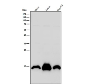 Histone H2A (mono methyl K118) Antibody / HIST1H2A Nucleosome Stability Antibody (clone 31H85) for WB. Western blot analysis of HIST1H2A / Histone H2A Lys118 monomethylation (H2AK118me1) in human cell lysates including HeLa, Jurkat, and HepG2 using Histone H2A (mono methyl K118) Antibody / HIST1H2A Nucleosome Stability Antibody. A band is detected at the predicted molecular weight of approximately 14 kDa corresponding to monomethylated Histone H2A, consistent with nucleosome-associated chromatin and structural regulation of chromatin stability.