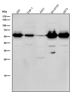 Western blot testing of human samples using the Phospho-Beta Arrestin 1 (pSer412) antibody at 1:1000 dilution for 1 hour at room temperature. Western blot analysis of phospho-beta-arrestin 1 (pSer412) shows a dominant band at ~55 kDa and a secondary band near ~37 kDa across multiple cell lines. Although the predicted size of beta-arrestin 1 is ~47 kDa, phosphorylation at Ser412 causes an upward mobility shift, while the lower band likely represents a truncated or partially degraded form of the protein.