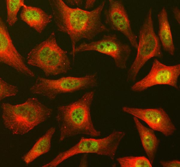 DNMT3A Antibody IF. Immunofluorescent staining of DNMT3A using anti-DNMT3A antibody (green) and anti-Beta Tubulin antibody (red). DNMT3A was detected in an immunocytochemical section of Hela cells. Enzyme antigen retrieval was performed using IHC enzyme antigen retrieval reagent for 15 mins. The cells were blocked with 10% goat serum. And then incubated with 5 ug/ml rabbit anti-DNMT3A antibody and mouse anti-Beta Tubulin antibody overnight at 4oC. DyLight 488 Conjugated Goat Anti-Rabbit IgG and DyLight 550 Conjugated Goat Anti-Mouse IgG were used as secondary antibody at 1:500 dilution and incubated for 30 minutes at 37oC. Visualize using a fluorescence microscope and filter sets appropriate for the label used.