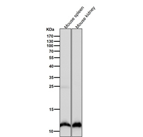 Histone H4 (mono methyl K20) Antibody Mouse Tissue WB. Western blot analysis of HIST1H4 / Histone H4 lysine 20 monomethylation (H4K20me1) in mouse spleen and mouse kidney tissue lysates using Histone H4 (mono methyl K20) Antibody / HIST1H4 Chromatin Compaction Regulation Antibody. A band is detected at the predicted molecular weight corresponding to monomethylated Histone H4, consistent with nuclear chromatin-associated localization and its role in chromatin compaction and genome stability across tissues.