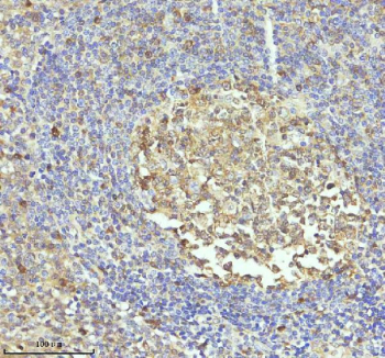 Immunohistochemical staining of Caspase 3 using anti-CASP3 antibody. Caspase 3 was detected in a paraffin-embedded section of human tonsil tissue. Heat mediated antigen retrieval was performed in EDTA buffer (pH 8.0, epitope retrieval solution). The tissue section was blocked with 10% goat serum. The tissue section was then incubated with 1:50 rabbit anti-CASP3 antibody overnight at 4oC. Peroxidase Conjugated Goat Anti-rabbit IgG was used as secondary antibody and incubated for 30 minutes at 37oC. The tissue section was developed using an HRP secondary and DAB substrate.