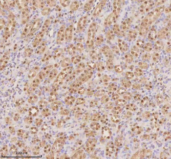 Immunohistochemical staining of PTRHD1 using anti-PTRHD1 antibody. PTRHD1 was detected in a paraffin-embedded section of rat kidney tissue. Heat mediated antigen retrieval was performed in EDTA buffer (pH 8.0, epitope retrieval solution). The tissue section was blocked with 10% goat serum. The tissue section was then incubated with 2 ug/ml rabbit anti-PTRHD1 antibody overnight at 4oC. Peroxidase Conjugated Goat Anti-rabbit IgG was used as secondary antibody and incubated for 30 minutes at 37oC. The tissue section was developed using an HRP secondary and DAB substrate.