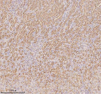 Immunohistochemical staining of PTRHD1 using anti-PTRHD1 antibody. PTRHD1 was detected in a paraffin-embedded section of rat kidney tissue. Heat mediated antigen retrieval was performed in EDTA buffer (pH 8.0, epitope retrieval solution). The tissue section was blocked with 10% goat serum. The tissue section was then incubated with 2 ug/ml rabbit anti-PTRHD1 antibody overnight at 4oC. Peroxidase Conjugated Goat Anti-rabbit IgG was used as secondary antibody and incubated for 30 minutes at 37oC. The tissue section was developed using an HRP secondary and DAB substrate.