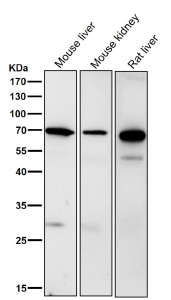Western blot testing of mouse samples using the RPN1 antibody at 1:3000 dilution for 1 hour at room temperature. A predominant band is detected at an approximately 68 kDa in all samples, consistent with the mature N-glycosylated ER membrane protein ribophorin I described in the literature. Additional weaker bands between roughly 50 and 60 kDa, particularly in rodent liver, likely represent truncated or processed RPN1 species generated during normal ER associated degradation rather than distinct full length isoforms.