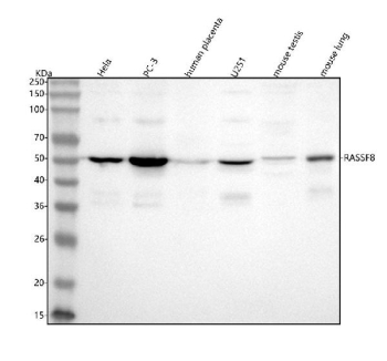 Western blot analysis of RASSF8 using anti-RASSF8 antibody. Lane 1: human Hela whole cell lysates, Lane 2: human PC-3 whole cell lysates, Lane 3: human placenta tissue lysates, Lane 4: human U251 whole cell lysates, Lane 5: mouse testis tissue lysates, Lane 6: mouse lung tissue lysates. After electrophoresis, proteins were transferred to a nitrocellulose membrane at 150 mA for 50-90 minutes. Blocked the membrane with 5% non-fat milk/TBS for 1.5 hour at RT. The membrane was incubated with rabbit anti-RASSF8 antibody at 0.5 ug/ml overnight at 4oC, then washed with TBS-0.1%Tween 3 times with 5 minutes each and probed with a goat anti-rabbit IgG-HRP secondary antibody at a dilution of 1:5000 for 1.5 hour at RT. The signal was developed using enhanced chemiluminescent. A specific band was detected for RASSF8 at approximately 48 kDa. The expected molecular weight of RASSF8 is ~48 kDa.