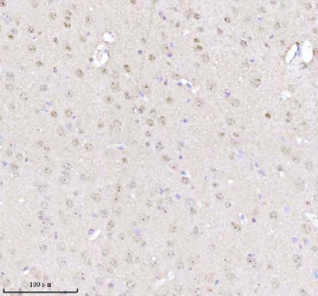 Immunohistochemical staining of MECP2 using anti-MECP2 antibody. MECP2 was detected in a paraffin-embedded section of mouse brain tissue. Heat mediated antigen retrieval was performed in EDTA buffer (pH 8.0, epitope retrieval solution). The tissue section was blocked with 10% goat serum. The tissue section was then incubated with 2 ug/ml rabbit anti-MECP2 antibody overnight at 4oC. Peroxidase Conjugated Goat Anti-rabbit IgG was used as secondary antibody and incubated for 30 minutes at 37oC. The tissue section was developed using an HRP secondary and DAB substrate.
