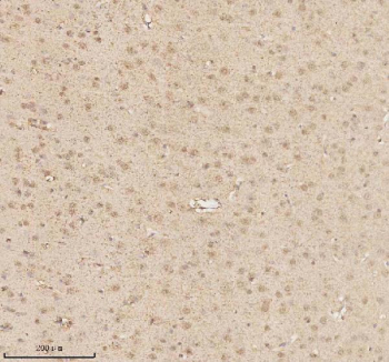 Immunohistochemical staining of MECP2 using anti-MECP2 antibody. MECP2 was detected in a paraffin-embedded section of rat brain tissue. Heat mediated antigen retrieval was performed in EDTA buffer (pH 8.0, epitope retrieval solution). The tissue section was blocked with 10% goat serum. The tissue section was then incubated with 2 ug/ml rabbit anti-MECP2 antibody overnight at 4oC. Peroxidase Conjugated Goat Anti-rabbit IgG was used as secondary antibody and incubated for 30 minutes at 37oC. The tissue section was developed using an HRP secondary and DAB substrate.