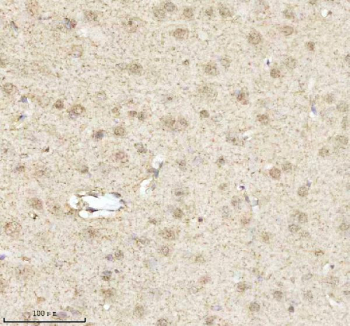Immunohistochemical staining of MECP2 using anti-MECP2 antibody. MECP2 was detected in a paraffin-embedded section of rat brain tissue. Heat mediated antigen retrieval was performed in EDTA buffer (pH 8.0, epitope retrieval solution). The tissue section was blocked with 10% goat serum. The tissue section was then incubated with 2 ug/ml rabbit anti-MECP2 antibody overnight at 4oC. Peroxidase Conjugated Goat Anti-rabbit IgG was used as secondary antibody and incubated for 30 minutes at 37oC. The tissue section was developed using an HRP secondary and DAB substrate.