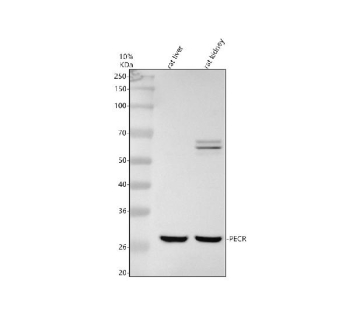 Western blot analysis of PECR using anti-PECR antibody. Electrophoresis was performed on a 10% SDS-PAGE gel at 80V (Stacking gel) / 120V (Resolving gel) for 2 hours. Lane 1: rat liver tissue lysates, Lane 2: rat kidney tissue lysates. After electrophoresis, proteins were transferred to a nitrocellulose membrane at 150 mA for 50-90 minutes. Blocked the membrane with 5% non-fat milk/TBS for 1.5 hour at RT. The membrane was incubated with rabbit anti-PECR antibody at 0.5 ug/ml overnight at 4oC, then washed with TBS-0.1%Tween 3 times with 5 minutes each and probed with a goat anti-rabbit IgG-HRP secondary antibody at a dilution of 1:5000 for 1.5 hour at RT. The signal was developed using an ECL Plus Western Blotting Substrate. A dominant band is detected between an approximately 28 and 30 kDa in both tissues, running slightly below the predicted ~33 kDa mass. This is consistent with the processed mature form of the peroxisomal enzyme PECR, which is expected to migrate a few kilodaltons lower than the 32-33 kDa precursor in vivo.