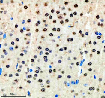Immunohistochemical staining of SCAF11 using anti-SCAF11 antibody. SCAF11 was detected in a paraffin-embedded section of mouse brain tissue. Heat mediated antigen retrieval was performed in EDTA buffer (pH 8.0, epitope retrieval solution). The tissue section was blocked with 10% goat serum. The tissue section was then incubated with 2 ug/ml rabbit anti-SCAF11 antibody overnight at 4oC. Peroxidase Conjugated Goat Anti-rabbit IgG was used as secondary antibody and incubated for 30 minutes at 37oC. The tissue section was developed using an HRP secondary and DAB substrate.