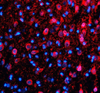 Immunofluorescent staining of TDP1 using anti-TDP1 antibody (red). TDP1 was detected in a paraffin-embedded section of rat brain tissue. Heat mediated antigen retrieval was performed in EDTA buffer (pH 8.0, epitope retrieval solution). The tissue section was blocked with 10% goat serum. The tissue section was then incubated with 5 ug/ml rabbit anti-TDP1 antibody overnight at 4oC. Cy3 Conjugated Goat Anti-Rabbit IgG was used as secondary antibody at 1:500 dilution and incubated for 30 minutes at 37oC. The section was counterstained with DAPI nuclear stain (blue). Visualize using a fluorescence microscope and filter sets appropriate for the label used.