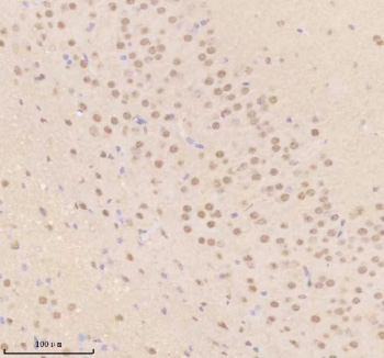 Immunohistochemical staining of TDP1 using anti-TDP1 antibody. TDP1 was detected in a paraffin-embedded section of mouse brain tissue. Heat mediated antigen retrieval was performed in EDTA buffer (pH 8.0, epitope retrieval solution). The tissue section was blocked with 10% goat serum. The tissue section was then incubated with 2 ug/ml rabbit anti-TDP1 antibody overnight at 4oC. Peroxidase Conjugated Goat Anti-rabbit IgG was used as secondary antibody and incubated for 30 minutes at 37oC. The tissue section was developed using an HRP secondary and DAB substrate.