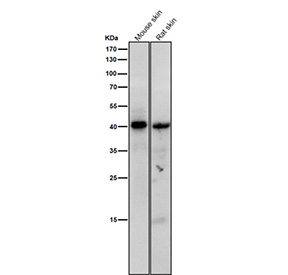 Western blot testing of mouse and rat skin tissue lysate using the Phospho-PKA C (pThr197) antibody at 1:1000 dilution for 1 hour at room temperature. The predicted molecular weight of P-PRKA/C/G is ~40 kDa.