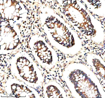 Immunohistochemical staining of STXBP3 using anti-STXBP3 antibody. STXBP3 was detected in a paraffin-embedded section of human colon tissue. Heat mediated antigen retrieval was performed in EDTA buffer (pH 8.0, epitope retrieval solution). The tissue section was blocked with 10% goat serum. The tissue section was then incubated with 2 ug/ml rabbit anti-STXBP3 antibody overnight at 4oC. Peroxidase Conjugated Goat Anti-rabbit IgG was used as secondary antibody and incubated for 30 minutes at 37oC. The tissue section was developed using an HRP secondary and DAB substrate.