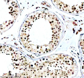Immunohistochemical staining of TAOK2 using anti-TAOK2 antibody. TAOK2 was detected in a paraffin-embedded section of human testis tissue. Heat mediated antigen retrieval was performed in EDTA buffer (pH 8.0, epitope retrieval solution). The tissue section was blocked with 10% goat serum. The tissue section was then incubated with 2 ug/ml rabbit anti-TAOK2 antibody overnight at 4oC. Peroxidase Conjugated Goat Anti-rabbit IgG was used as secondary antibody and incubated for 30 minutes at 37oC. The tissue section was developed using an HRP secondary and DAB substrate.