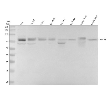 Western blot analysis of TBKBP1 using anti-TBKBP1 antibody. Electrophoresis was performed on a 10% SDS-PAGE gel at 80V (Stacking gel) / 120V (Resolving gel) for 2 hours. Lane 1: human HEL whole cell lysates, Lane 2: human Caco-2 whole cell lysates, Lane 3: human 293T whole cell lysates, Lane 4: human SH-SY5Y whole cell lysates, Lane 5: rat lung tissue lysates, Lane 6: rat brain tissue lysates, Lane 7: mouse lung tissue lysates, Lane 8: mouse brain tissue lysates. After electrophoresis, proteins were transferred to a nitrocellulose membrane at 150 mA for 50-90 minutes. Blocked the membrane with 5% non-fat milk/TBS for 1.5 hour at RT. The membrane was incubated with rabbit anti-TBKBP1 antibody at 0.5 ug/ml overnight at 4oC, then washed with TBS-0.1%Tween 3 times with 5 minutes each and probed with a goat anti-rabbit IgG-HRP secondary antibody at a dilution of 1:5000 for 1.5 hour at RT. The signal was developed using an ECL Plus Western Blotting Substrate. A predominant band is detected at an approximately 78 kDa in all samples, running above the predicted ~68 kDa size but consistent with the higher apparent molecular weight expected for a coiled-coil adaptor protein with multiple post translational modifications. Some lysates also display a weaker band between ~65 and 70 kDa, likely representing a less modified or partially processed form of TBKBP1.