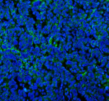 Immunohistochemical staining of SPA17 using anti-SPA17 antibody (green). SPA17 was detected in a paraffin-embedded section of human placenta tissue. Heat mediated antigen retrieval was performed in EDTA buffer (pH 8.0, epitope retrieval solution). The tissue section was blocked with 10% goat serum. The tissue section was then incubated with 2 ug/ml rabbit anti-SPA17 antibody overnight at 4oC. Peroxidase Conjugated Goat Anti-rabbit IgG was used as secondary antibody and incubated for 30 minutes at 37oC. The tissue section was developed using an HRP secondary and DAB substrate.