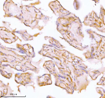 Immunohistochemical staining of SPA17 using anti-SPA17 antibody. SPA17 was detected in a paraffin-embedded section of human placenta tissue. Heat mediated antigen retrieval was performed in EDTA buffer (pH 8.0, epitope retrieval solution). The tissue section was blocked with 10% goat serum. The tissue section was then incubated with 2 ug/ml rabbit anti-SPA17 antibody overnight at 4oC. Peroxidase Conjugated Goat Anti-rabbit IgG was used as secondary antibody and incubated for 30 minutes at 37oC. The tissue section was developed using an HRP secondary and DAB substrate.