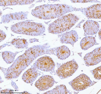 Immunohistochemical staining of SPA17 using anti-SPA17 antibody. SPA17 was detected in a paraffin-embedded section of mouse testis tissue. Heat mediated antigen retrieval was performed in EDTA buffer (pH 8.0, epitope retrieval solution). The tissue section was blocked with 10% goat serum. The tissue section was then incubated with 2 ug/ml rabbit anti-SPA17 antibody overnight at 4oC. Peroxidase Conjugated Goat Anti-rabbit IgG was used as secondary antibody and incubated for 30 minutes at 37oC. The tissue section was developed using an HRP secondary and DAB substrate.