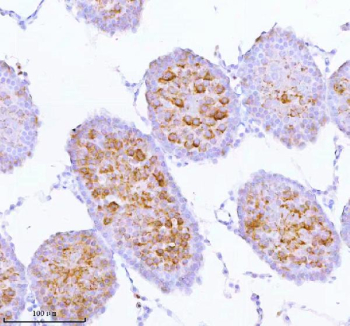 Immunohistochemical staining of SPA17 using anti-SPA17 antibody. SPA17 was detected in a paraffin-embedded section of rat testis tissue. Heat mediated antigen retrieval was performed in EDTA buffer (pH 8.0, epitope retrieval solution). The tissue section was blocked with 10% goat serum. The tissue section was then incubated with 2 ug/ml rabbit anti-SPA17 antibody overnight at 4oC. Peroxidase Conjugated Goat Anti-rabbit IgG was used as secondary antibody and incubated for 30 minutes at 37oC. The tissue section was developed using an HRP secondary and DAB substrate.