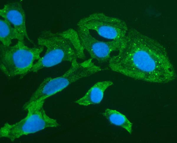 FOXL1 Antibody U2OS IF. Immunofluorescence analysis of U2OS cells stained with FOXI1 Antibody / Forkhead Transcription Factor Antibody (green). Forkhead box protein I1 / FOXI1 staining is observed throughout the cytoplasm with additional perinuclear signal in human U2OS cells, consistent with the dynamic intracellular distribution reported for FOX family transcription-associated regulatory proteins. Cells were subjected to enzyme-mediated antigen retrieval followed by incubation with rabbit anti-FOXI1 antibody and DyLight 488-conjugated secondary antibody. Nuclei are counterstained with DAPI (blue).