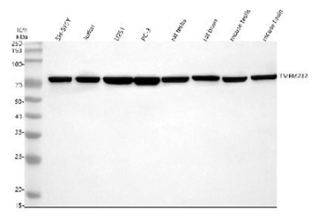TMEM232 Antibody Human / Mouse / Rat WB. Western blot analysis of TMEM232 using anti-TMEM232 antibody. Electrophoresis was performed on a 10% SDS-PAGE gel at 80V (Stacking gel) / 120V (Resolving gel) for 2 hours. Lane 1: human SH-SY5Y whole cell lysates, Lane 2: human Jurkat whole cell lysates, Lane 3: human U251 whole cell lysates, Lane 4: human PC-3 whole cell lysates, Lane 5: rat testis tissue lysates, Lane 6: rat brain tissue lysates, Lane 7: mouse testis tissue lysates, Lane 8: mouse brain tissue lysates. After electrophoresis, proteins were transferred to a nitrocellulose membrane at 150 mA for 50-90 minutes. Blocked the membrane with 5% non-fat milk/TBS for 1.5 hour at RT. The membrane was incubated with rabbit anti-TMEM232 antibody at 0.5 ug/ml overnight at 4oC, then washed with TBS-0.1%Tween 3 times with 5 minutes each and probed with a goat anti-rabbit IgG-HRP secondary antibody at a dilution of 1:5000 for 1.5 hour at RT. The signal was developed using an ECL Plus Western Blotting Substrate. A specific band was detected for TMEM232 at approximately 76 kDa. The expected molecular weight of TMEM232 is ~76 kDa.