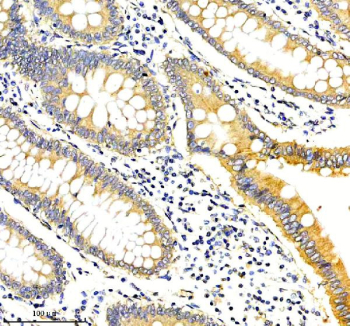 TMEM232 Antibody Human Colon Tissue IHC. Immunohistochemical staining of TMEM232 using anti-TMEM232 antibody. TMEM232 was detected in a paraffin-embedded section of human colon tissue. Heat mediated antigen retrieval was performed in EDTA buffer (pH 8.0, epitope retrieval solution). The tissue section was blocked with 10% goat serum. The tissue section was then incubated with 2 ug/ml rabbit anti-TMEM232 antibody overnight at 4oC. Peroxidase Conjugated Goat Anti-rabbit IgG was used as secondary antibody and incubated for 30 minutes at 37oC. The tissue section was developed using an HRP secondary and DAB substrate.