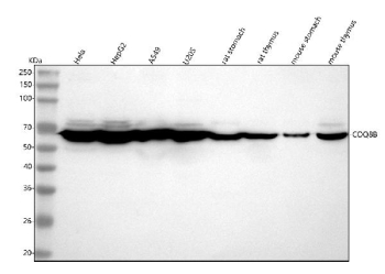Western blot analysis of COQ8B using anti-COQ8B antibody. Lane 1: human Hela whole cell lysates, Lane 2: human HepG2 whole cell lysates, Lane 3: human whole cell lysates, Lane 4: human U20S whole cell lysates, Lane 5: rat stomach tissue lysates, Lane 6: rat thymus tissue lysates, Lane 7: mouse stomach tissue lysates, Lane 8: mouse thymus tissue lysates. After electrophoresis, proteins were transferred to a nitrocellulose membrane at 150 mA for 50-90 minutes. Blocked the membrane with 5% non-fat milk/TBS for 1.5 hour at RT. The membrane was incubated with rabbit anti-COQ8B antibody at 0.25 ug/ml overnight at 4oC, then washed with TBS-0.1%Tween 3 times with 5 minutes each and probed with a goat anti-rabbit IgG-HRP secondary antibody at a dilution of 1:5000 for 1.5 hour at RT. The signal was developed using enhanced chemiluminescent. The expected molecular weight of COQ8B is ~60 kDa.