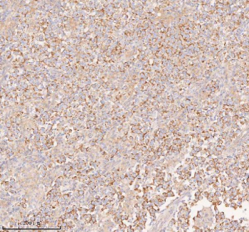 Immunohistochemical staining of COQ8B using anti-COQ8B antibody. COQ8B was detected in a paraffin-embedded section of human testicular seminoma tissue. Heat mediated antigen retrieval was performed in EDTA buffer (pH 8.0, epitope retrieval solution). The tissue section was blocked with 10% goat serum. The tissue section was then incubated with 2 ug/ml rabbit anti-COQ8B antibody overnight at 4oC. Peroxidase Conjugated Goat Anti-rabbit IgG was used as secondary antibody and incubated for 30 minutes at 37oC. The tissue section was developed using an HRP secondary and DAB substrate.