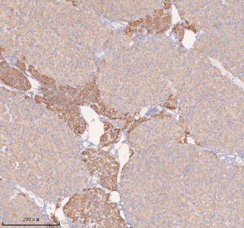 Immunohistochemical staining of COQ8B using anti-COQ8B antibody. COQ8B was detected in a paraffin-embedded section of mouse ovary tissue. Heat mediated antigen retrieval was performed in EDTA buffer (pH 8.0, epitope retrieval solution). The tissue section was blocked with 10% goat serum. The tissue section was then incubated with 2 ug/ml rabbit anti-COQ8B antibody overnight at 4oC. Peroxidase Conjugated Goat Anti-rabbit IgG was used as secondary antibody and incubated for 30 minutes at 37oC. The tissue section was developed using an HRP secondary and DAB substrate.